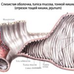 Slizistaja-obolochka-tonkoj-kishki