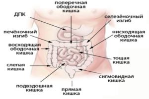 Воспаление подвздошной кишки симптомы