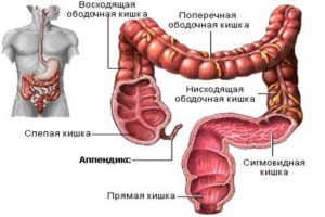 Диета при тифлите и колите