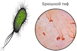 Бактериофаги при дисбактериозе у взрослых