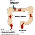 Gazoobrazovanie-v-kishechnike