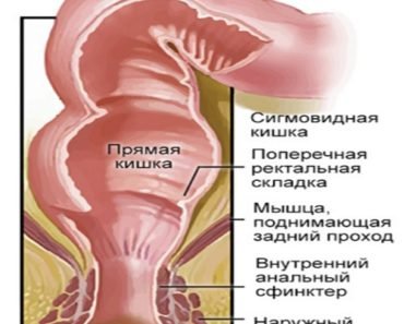 Prjamaja-kishka
