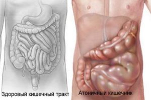 Какие продукты закрепляют организм