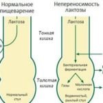 Neperenosimost-laktozy