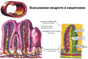 Колит толстого кишечника симптомы лечение