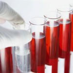 Анализ крови на паразитов