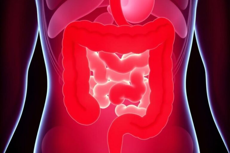 Лечение рака кишечника: разбираемся без страшилок