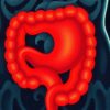 Der Appendix: ¿Tiene el apéndice una función después de todo?