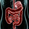 Parásitos intestinales: Síntomas silenciosos a los que debes prestar atención