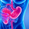 Diverticulitis: Symptoms, Causes, and Treatment Explained