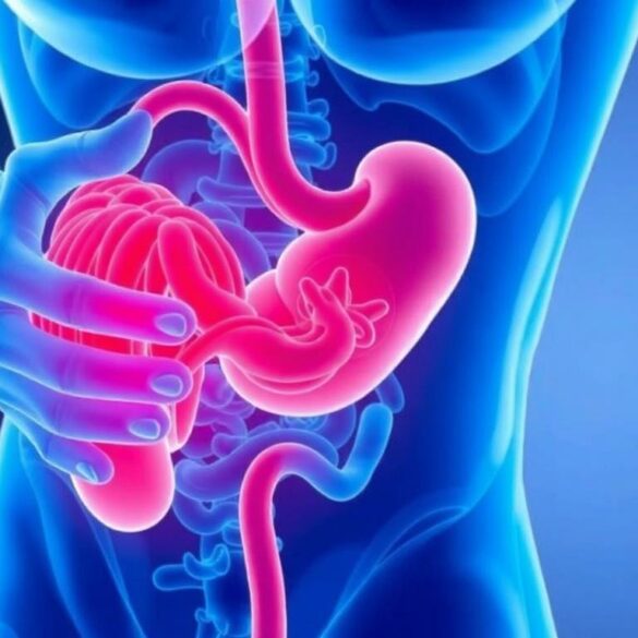 Diverticulitis: Symptoms, Causes, and Treatment Explained