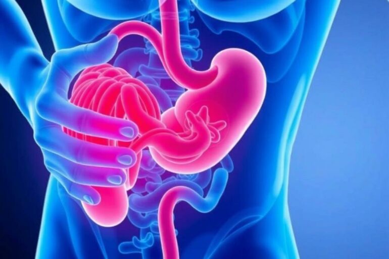 Diverticulitis: Symptoms, Causes, and Treatment Explained