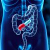 Der Einfluss von Antibiotika auf den Darm: Lo que los antibióticos hacen a tu microbiota y cómo protegerla