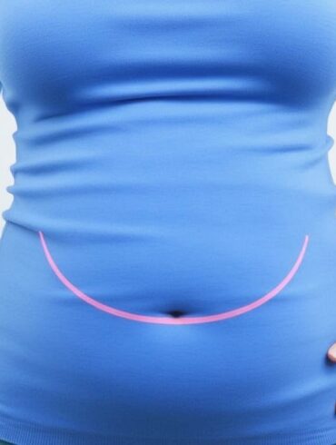 Ballonnements: las causas y cómo evitarlos de forma sencilla y efectiva