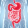 Candidiasis intestinal: cómo reconocerla y tratarla (Candidose intestinale : comment la reconnaître et la traiter ?)