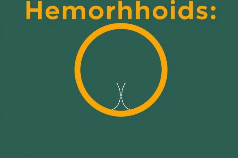 Hemorrhoids: Prevention and Treatment – A Complete Guide to Comfort and Relief