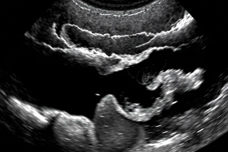 УЗИ желчного пузыря и поджелудочной: что проверяют, как подготовиться и что значат результаты