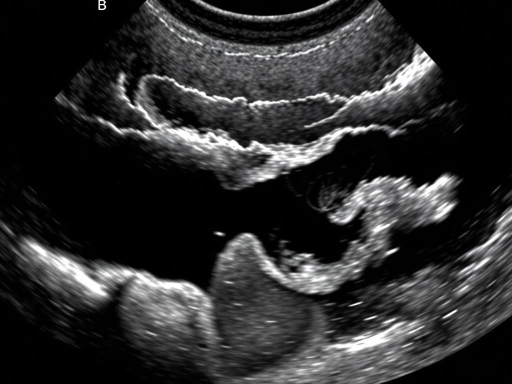 УЗИ желчного пузыря и поджелудочной: что проверяют, как подготовиться и что значат результаты