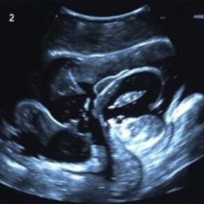 УЗИ брюшной полости: что это, зачем и как к нему подготовиться