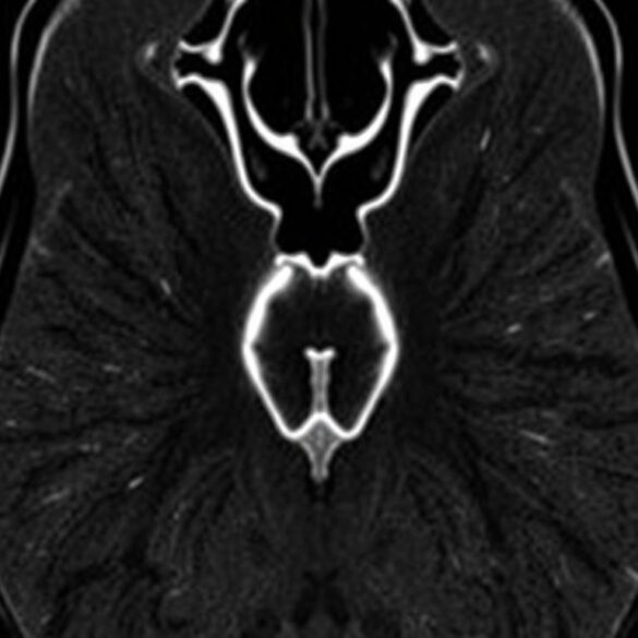 МРТ предстательной железы: что это, зачем и как к ней подготовиться